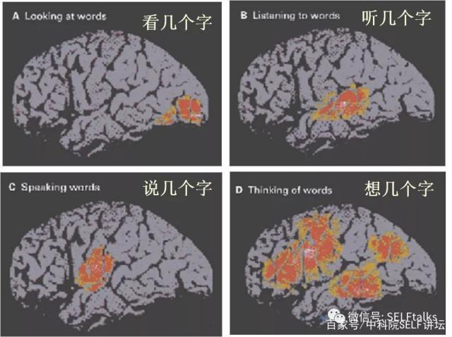 中國腦健康日關(guān)注“頭”等大事,中國腦科技的未來是什么?